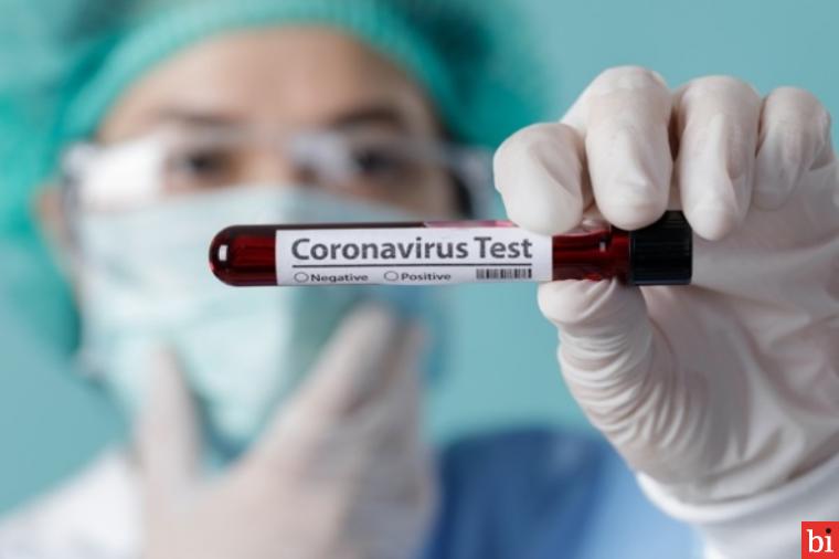 Kasus Baru Kembali Muncul di Kabupaten Solok, 3 Orang Warga Terinfeksi Virus Corona